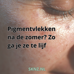 Pigmentvlekken na de zomer Zo ga je ze te lijf